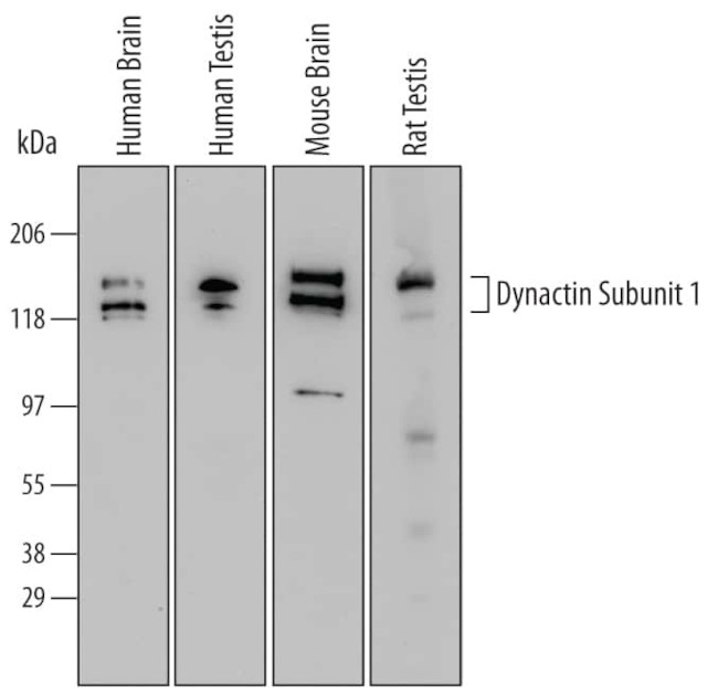 Dynactin 1 Antibody in Western Blot (WB)