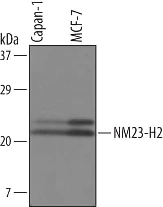 NME2 Antibody in Western Blot (WB)