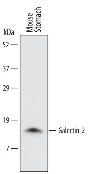 Galectin 2 Antibody in Western Blot (WB)
