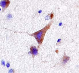 LRRK2 Antibody in Immunohistochemistry (Paraffin) (IHC (P))