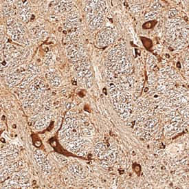 NENF Antibody in Immunohistochemistry (Paraffin) (IHC (P))