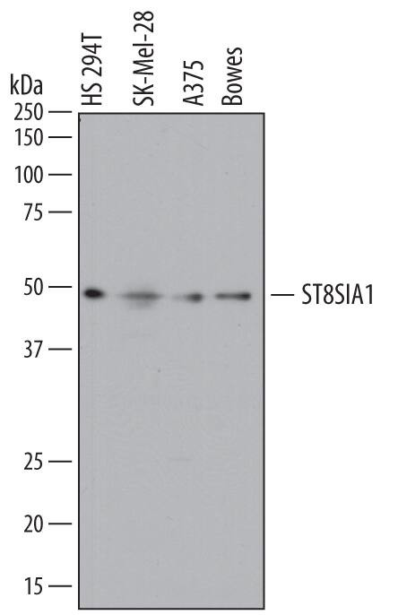 ST8SIA1 Antibody in Western Blot (WB)