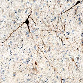 Cerebellin 4 Antibody in Immunohistochemistry (Paraffin) (IHC (P))