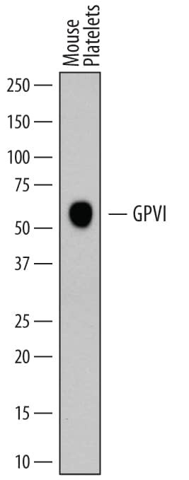 GP6 Antibody in Western Blot (WB)