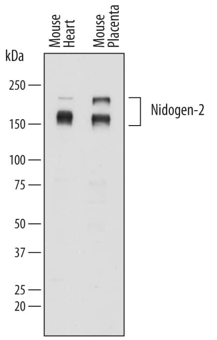 Nidogen 2 Antibody in Western Blot (WB)