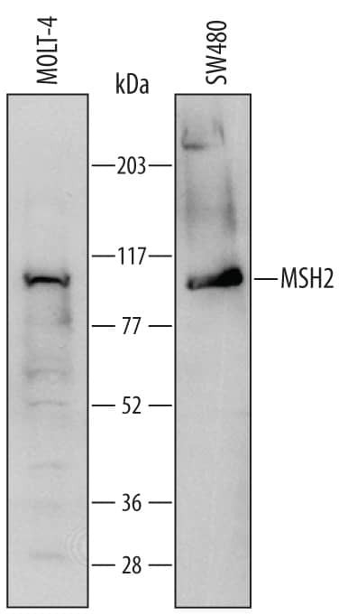 MSH2 Antibody in Western Blot (WB)