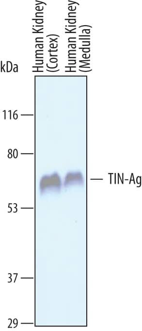 TINAG Antibody in Western Blot (WB)