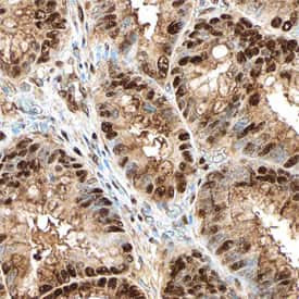 CDK8 Antibody in Immunohistochemistry (Paraffin) (IHC (P))