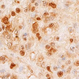 SMARCA5 Antibody in Immunohistochemistry (Paraffin) (IHC (P))