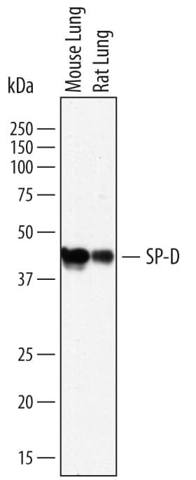 SFTPD Antibody in Western Blot (WB)