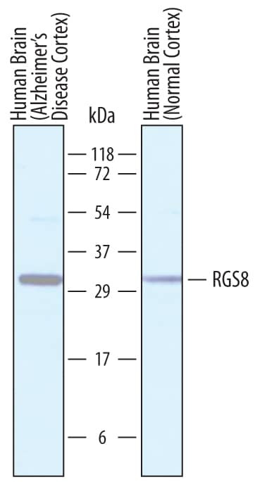 RGS8 Antibody in Western Blot (WB)