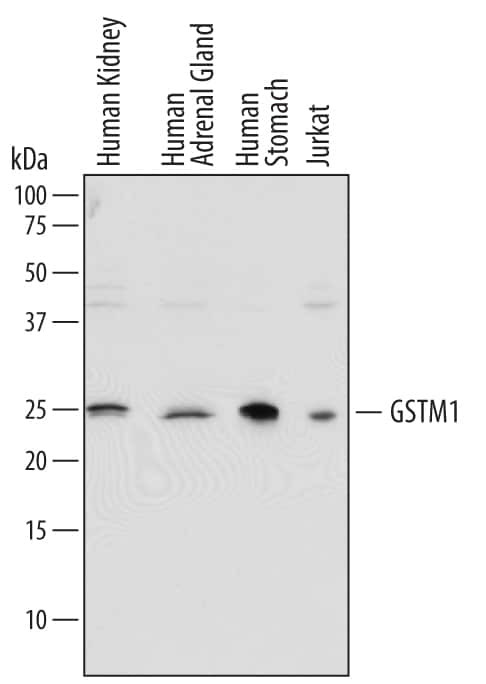 GSTM1 Antibody in Western Blot (WB)