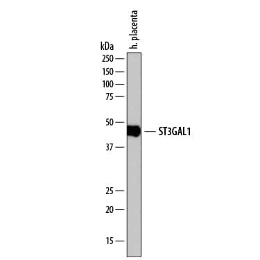 ST3GAL1 Antibody in Western Blot (WB)