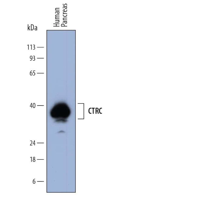 Chymotrypsin Antibody in Western Blot (WB)