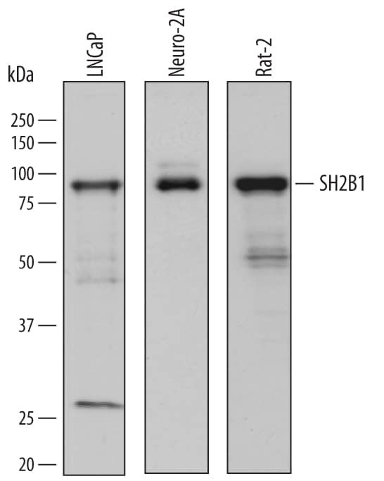 SH2B1 Antibody in Western Blot (WB)