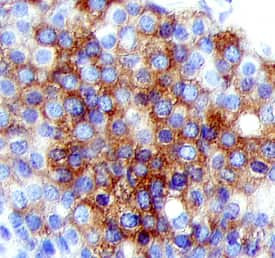 BRCA1 Antibody in Immunohistochemistry (Paraffin) (IHC (P))