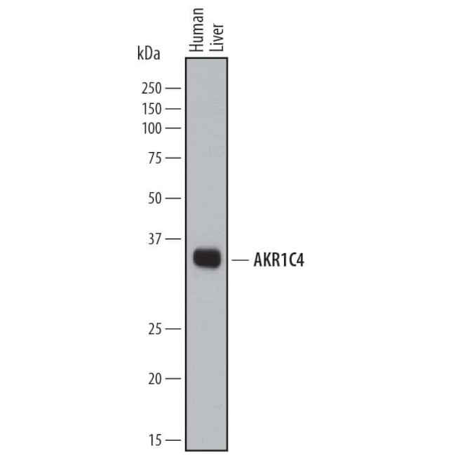 AKR1C4 Antibody in Western Blot (WB)
