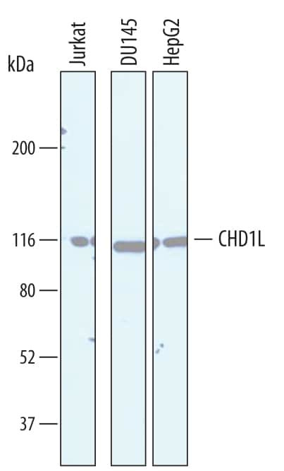 CHD1L Antibody in Western Blot (WB)