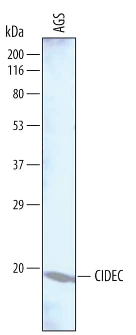 CIDEC Antibody in Western Blot (WB)