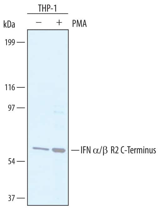 IFNAR2 Antibody in Western Blot (WB)