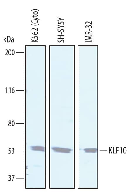 KLF10 Antibody in Western Blot (WB)