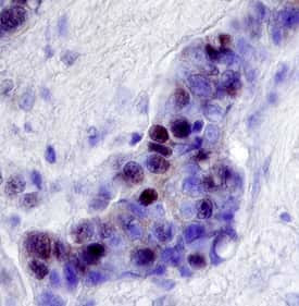 NCoR2 Antibody in Immunohistochemistry (Paraffin) (IHC (P))