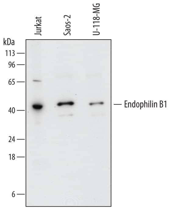 Bif1 Antibody in Western Blot (WB)