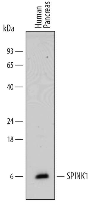 SPINK1 Antibody in Western Blot (WB)