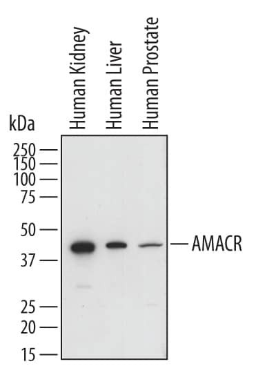 AMACR Antibody in Western Blot (WB)
