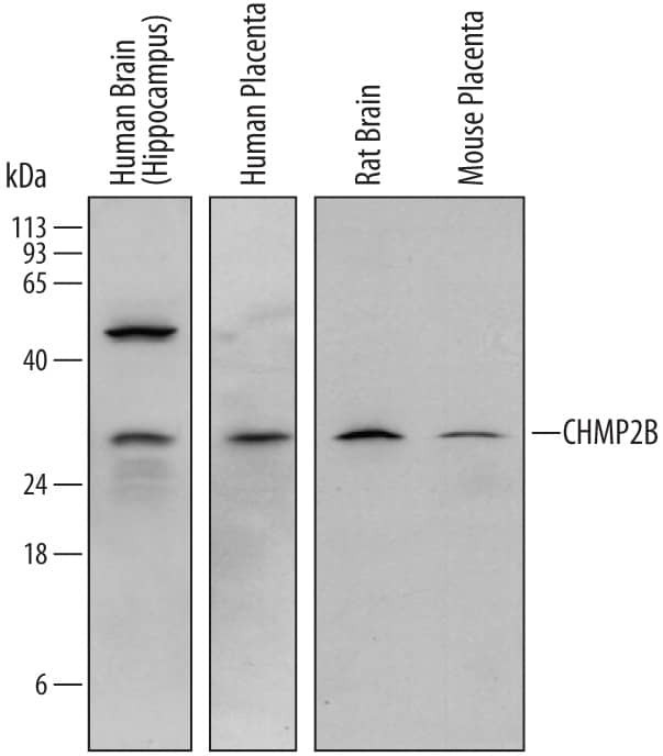 CHMP2B Antibody in Western Blot (WB)