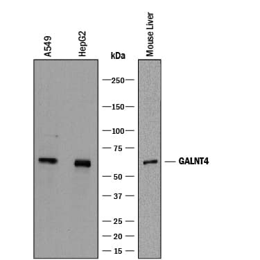 GALNT4 Antibody in Western Blot (WB)