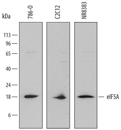 eIF5A Antibody in Western Blot (WB)