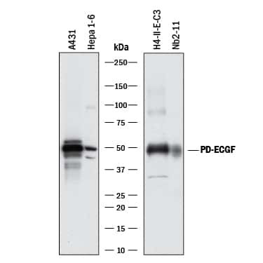 Thymidine Phosphorylase Antibody in Western Blot (WB)