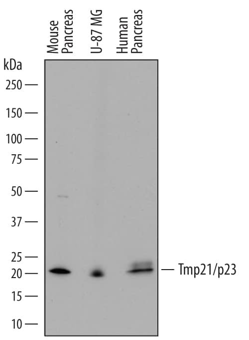 TMP21 Antibody in Western Blot (WB)