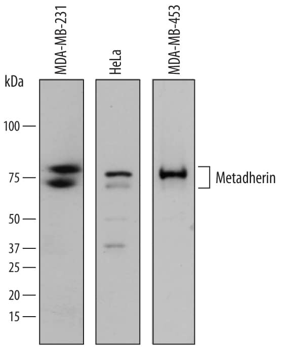 Metadherin Antibody in Western Blot (WB)
