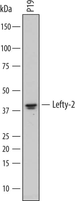 LEFTY2 Antibody in Western Blot (WB)