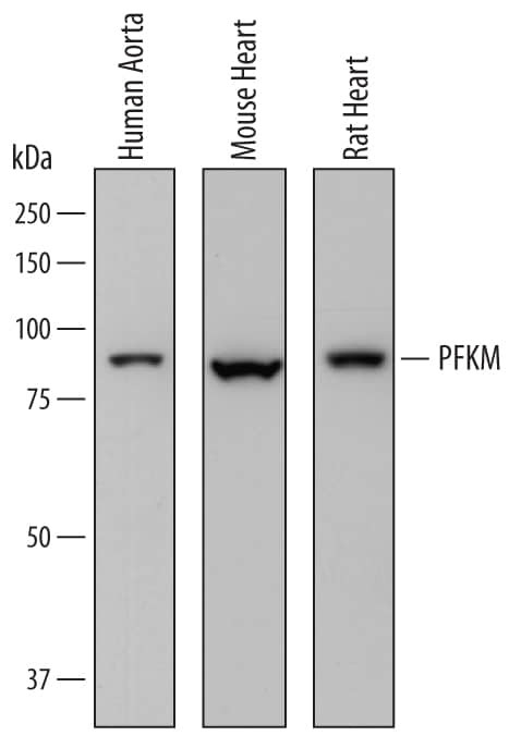 PFKM Antibody in Western Blot (WB)