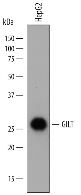 IFI30 Antibody in Western Blot (WB)