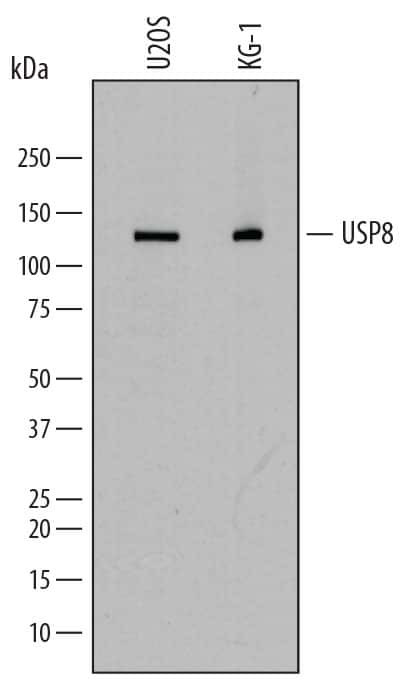 USP8 Antibody in Western Blot (WB)