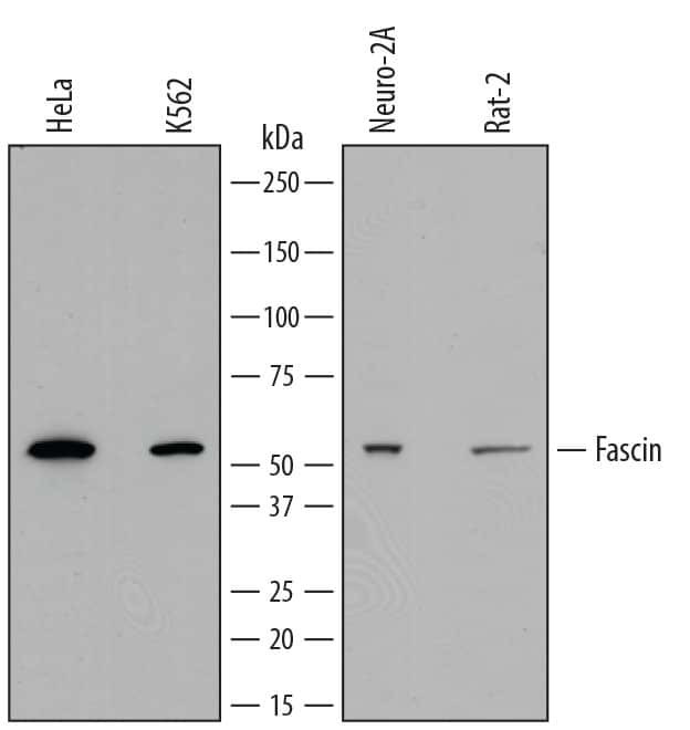Fascin Antibody in Western Blot (WB)