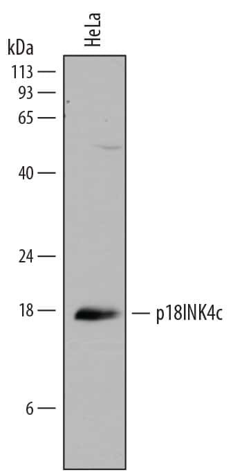 CDKN2C Antibody in Western Blot (WB)