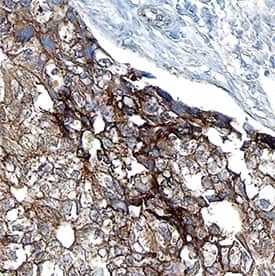 ACVR1C Antibody in Immunohistochemistry (Paraffin) (IHC (P))