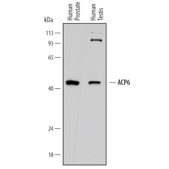ACP6 Antibody in Western Blot (WB)