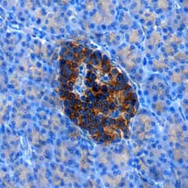 RFX6 Antibody in Immunohistochemistry (Paraffin) (IHC (P))