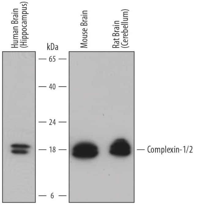 CPLX1/2 Antibody in Western Blot (WB)