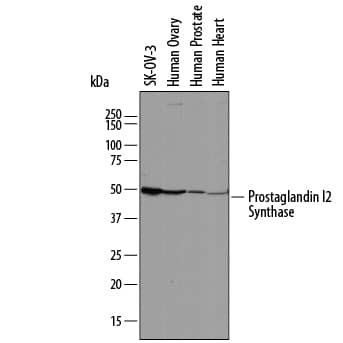 PTGIS Antibody in Western Blot (WB)