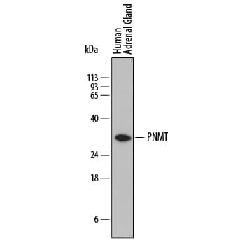 PNMT Antibody in Western Blot (WB)