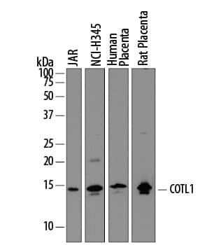 COTL1 Antibody in Western Blot (WB)