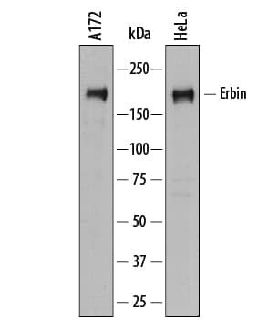 Erbin Antibody in Western Blot (WB)
