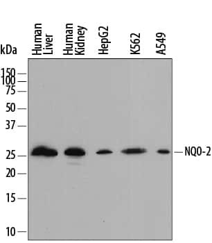 NQO2 Antibody in Western Blot (WB)